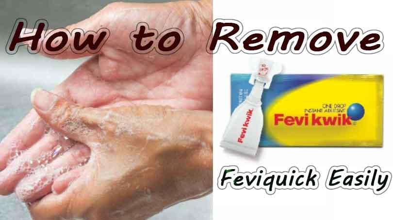 how to remove feviquick from hand